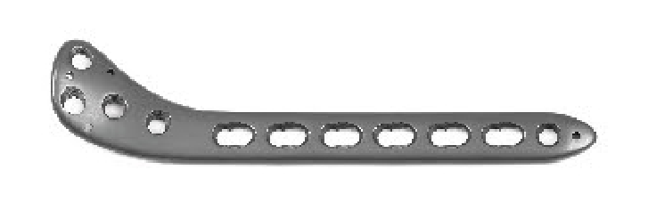 Медіальна підтримуюча блокуюча пластина для великогомілкової кістки UMP